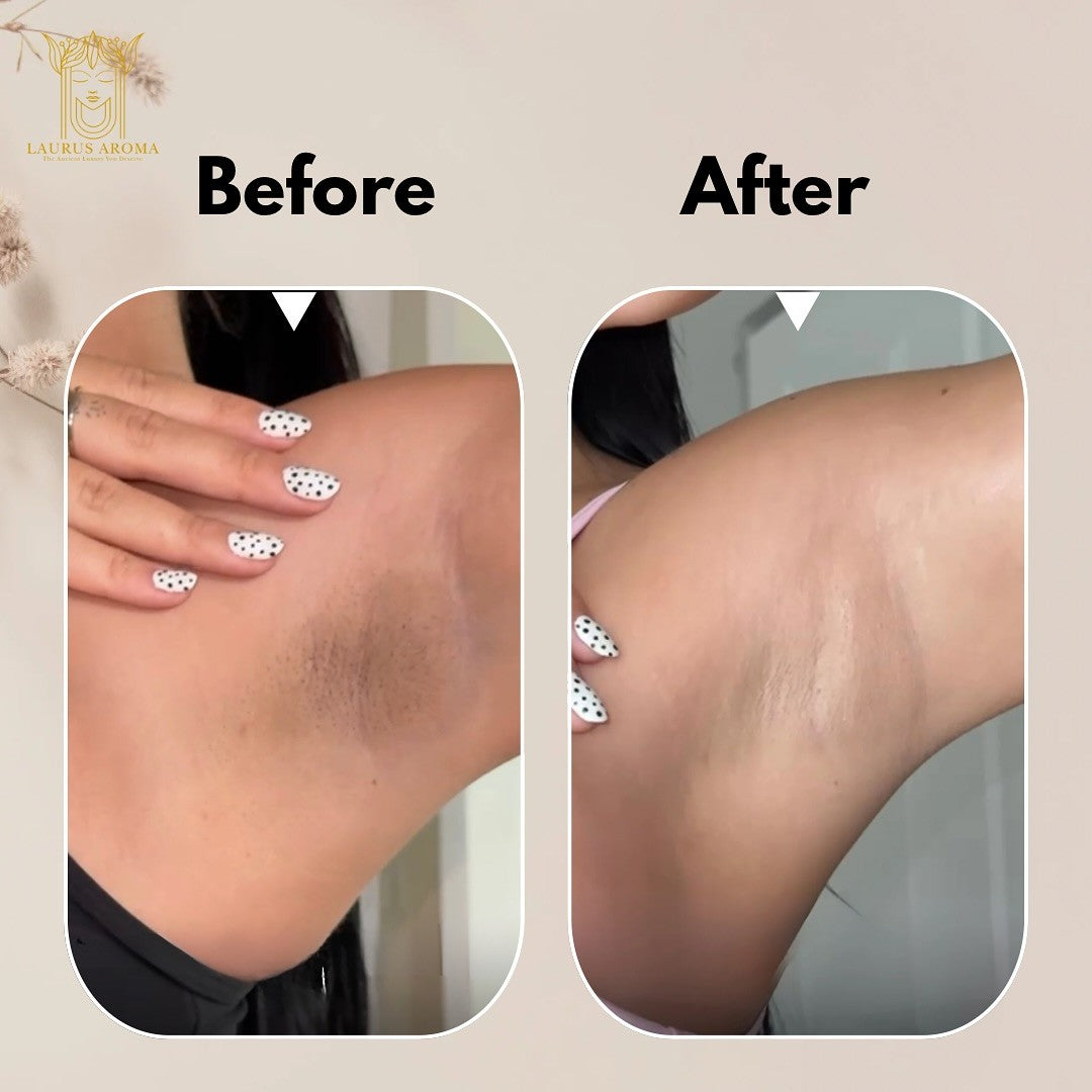 Brightening & Dark Spot Correction Bundle (2 Musk Soaps + 2 Lavender Soaps)